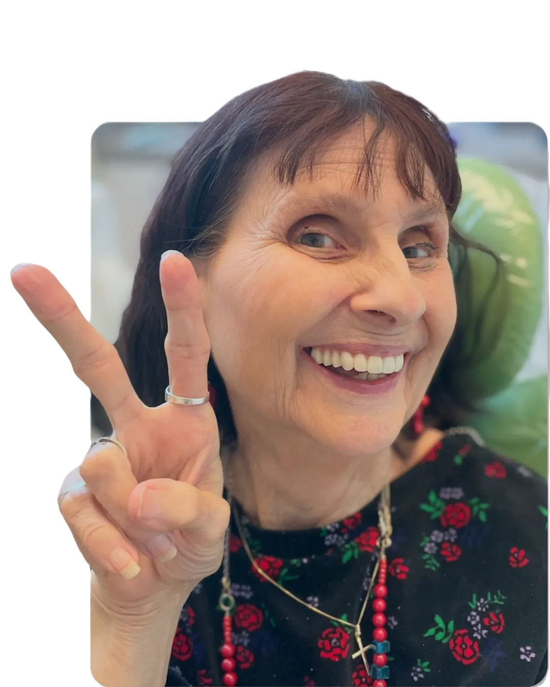 Linda B. Smileloc patient before and after smile transformation