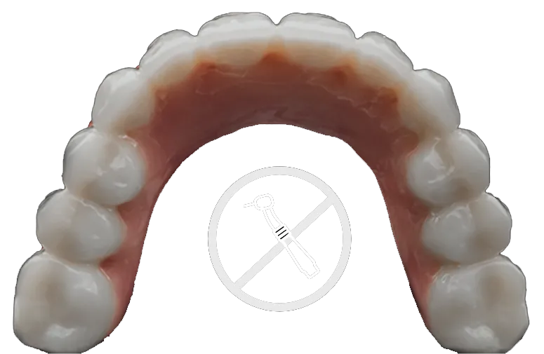 Smileloc screwless implants with no visible holes