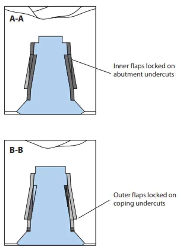 Figure 2. Cross-section view of flaps engaging undercut in abutment and restoration