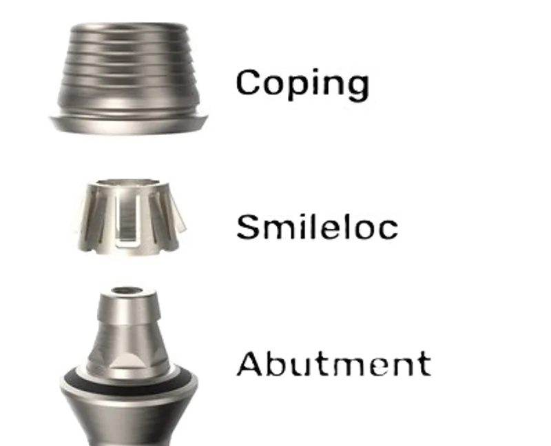 Smileloc abutment and sleeve system
