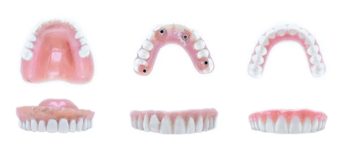 From Dentures to Smileloc®: A Real Life Guide to Full Arch Dental Options