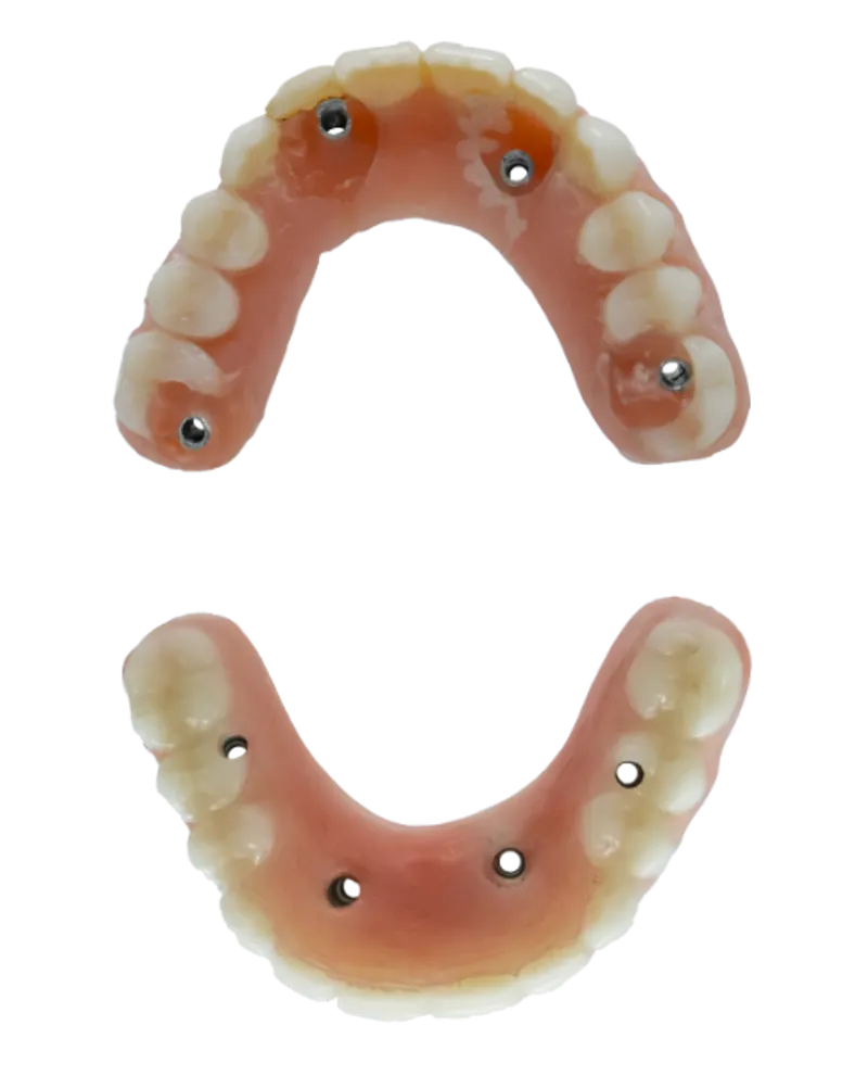 Teeth with screw holes in them