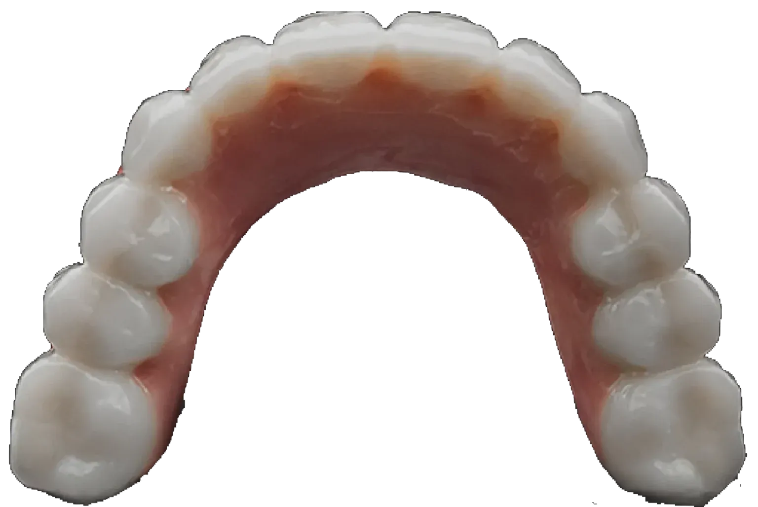 Revolutionary screwless dental implants from a top view